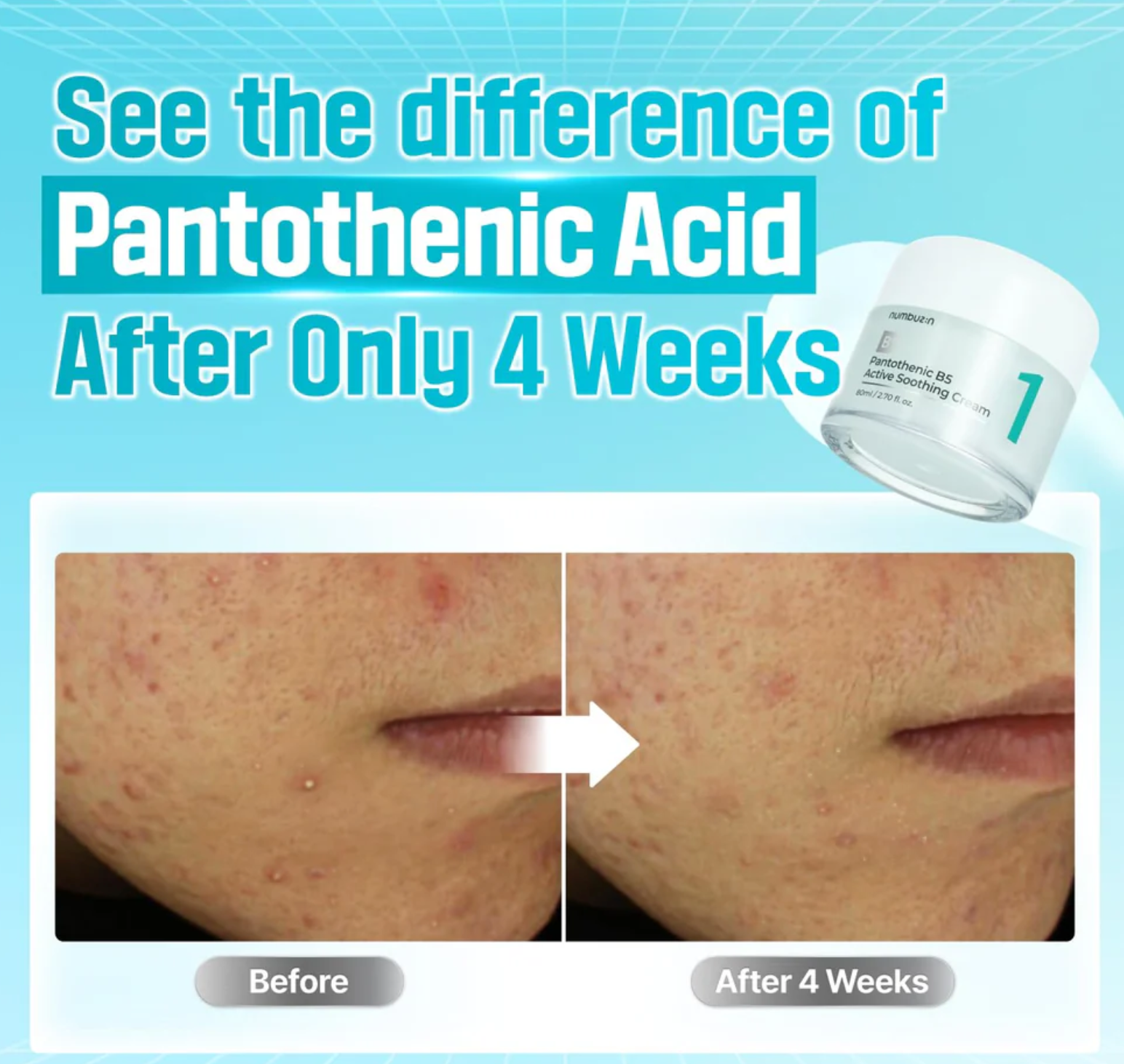 Numbuzin - No. 1 Pantothenic B5 Active Soothing Cream